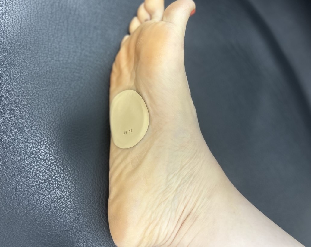 니코틴패치 가려움 때문에 발바닥에 붙인 모습